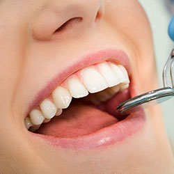 Bone Grafting