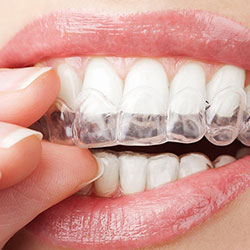 Orthodontics